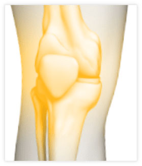 Total Knee